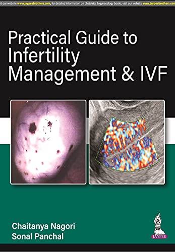 Practical Guide to Infertility Management &amp; IVF